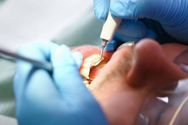 Best Weekend Emergency Dentist in Fulton, MO