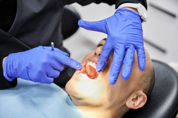 Best Broken or Cracked Tooth Emergency Dentist in Fulton, MO